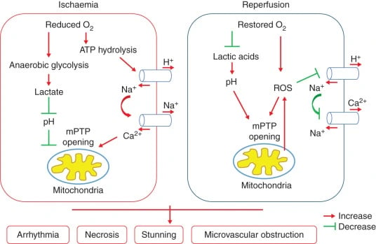 Fig. 4: Simplified schematic of the proposed cellular mechanisms underlying myocardial I/R injury. I/R increases the opening of the mitochondrial permeability transition pore (mPTP), increasing ROS generation, decreasing nitric oxide, and disrupting intracellular ion distribution and pH. This results in cell death and irreversible tissue injury. 6 Source: https://www.sciencedirect.com/science/article/pii/S0007091217301459.