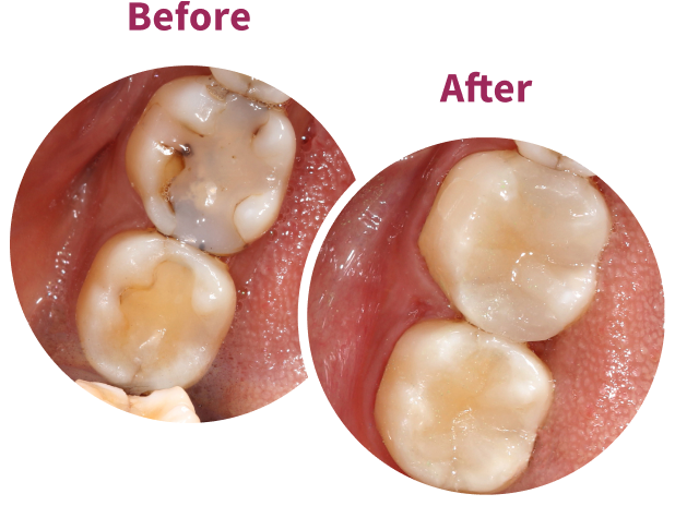 Transcend Before and After