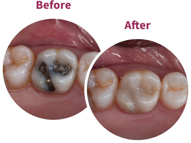 Transcend Before and After