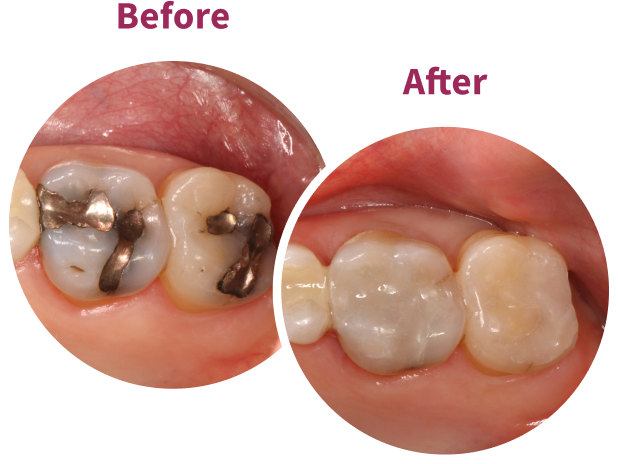 Transcend Before and After