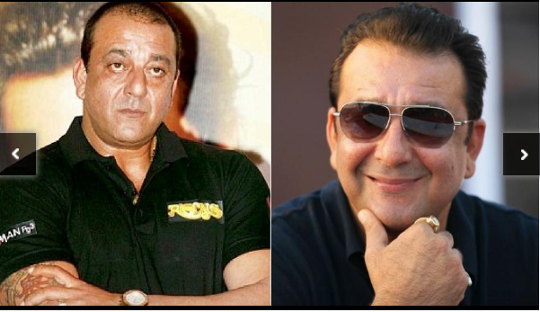 Indian Celebrities Hair Transplant: Top Bollywood Actors &amp; Celebrities with a Hair Transplant